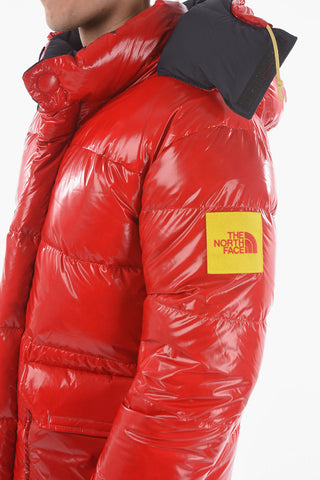 Oversized Down Parka with Removable Hood