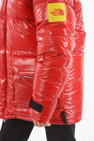 Oversized Down Parka with Removable Hood